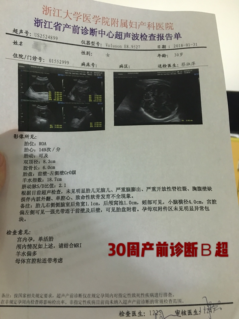 4个月胎儿羊水多少正常