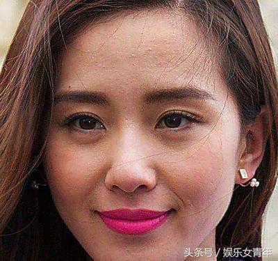 少女额头为何老长痘痘