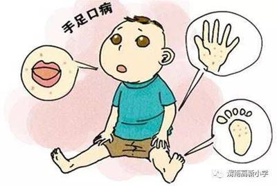 宝宝口腔疱疹怎么治疗