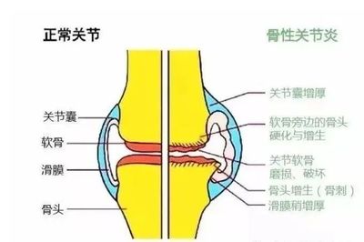 骨质破坏引起的疼痛怎么治疗