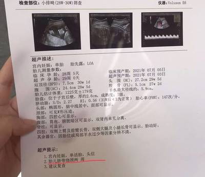怀孕36周脐带绕颈两周怎么办