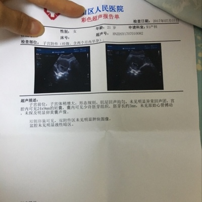 怎么去医院检查怀孕