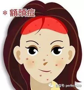 额头和脸上长痘痘怎么办