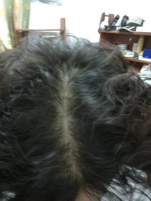 卷发烫毁了怎么办