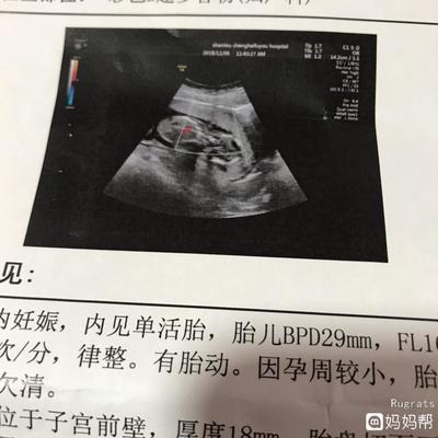 胎儿14周会有胎动吗