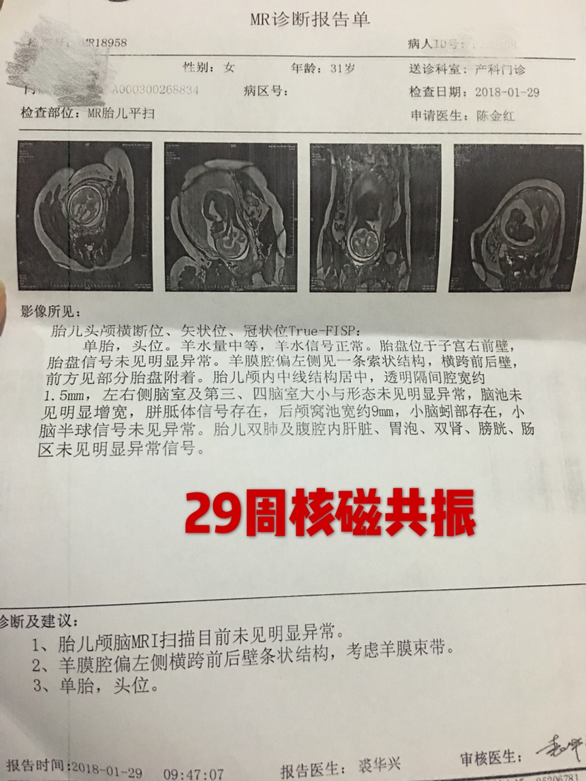 孕妇可以做核磁共振