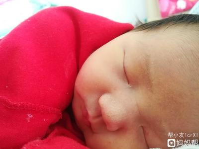 新生儿白点点是什么