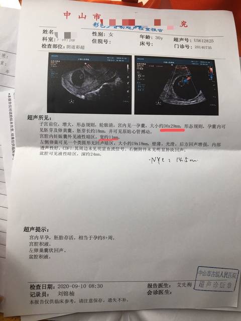 怀孕半个月会流产吗