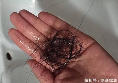 吃什么可以长发