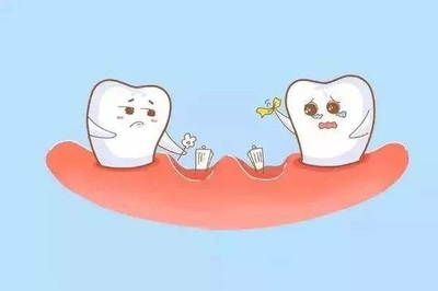 做梦梦到牙掉了两颗