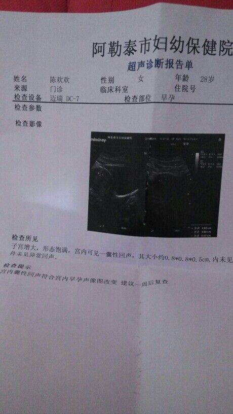 怎么看怀孕没