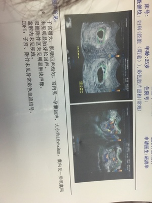 怀孕20天可以药流吗