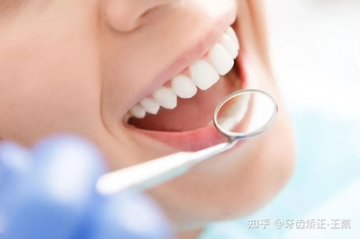 不拔牙可以矫正牙齿吗