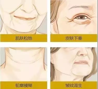 水光针能去皱纹吗
