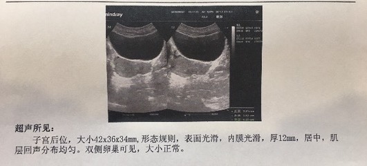 月经两个月来三次正常吗