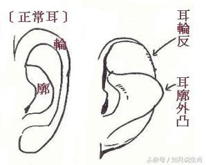 耳朵外廓疼是怎么回事