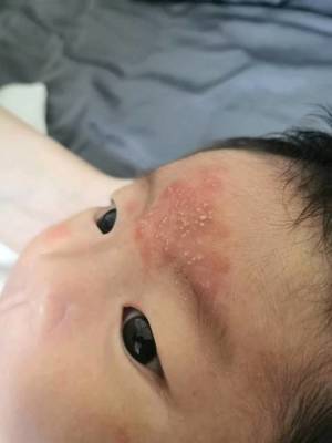 宝宝额头体温多少度算正常
