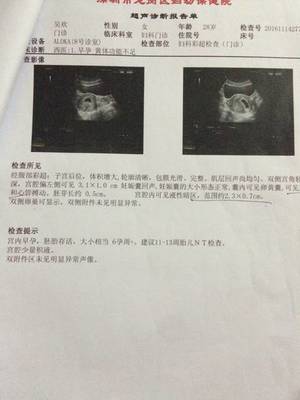 孕酮吃多了对胎儿有影响吗
