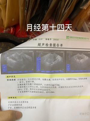 卵泡长不大会怀孕吗