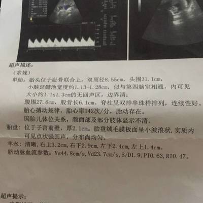 32周胎宝宝