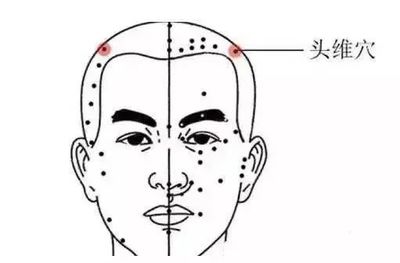 头顶按压疼是怎么回事