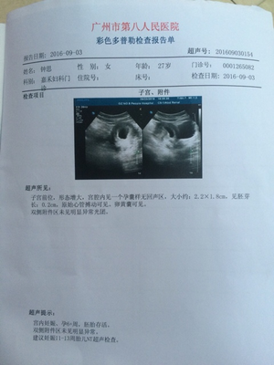 刚怀孕一周会恶心吗