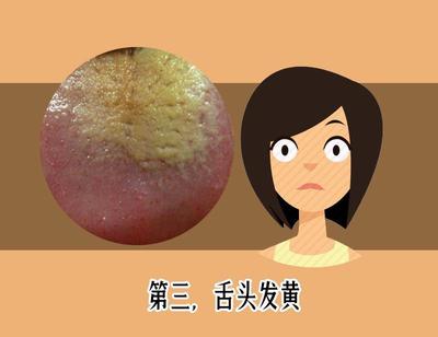 舌苔发绿是怎么回事