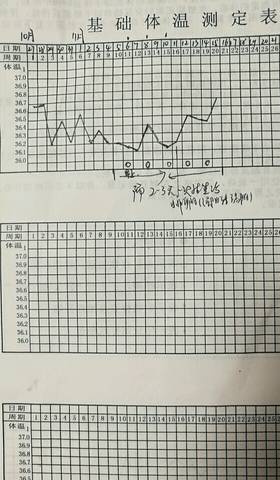 基础体温正常情况下是多少