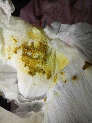 宝宝的便便有酸臭味