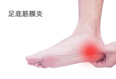 筋膜炎怎么治疗好得快