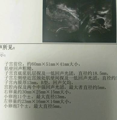 没排卵内膜多少正常