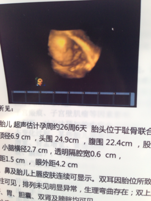 怀孕26周耻骨疼正常吗