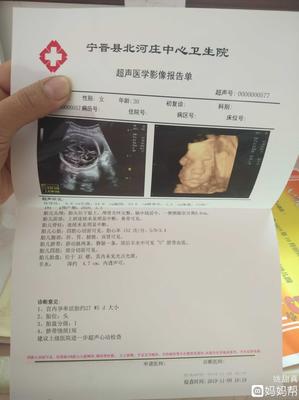 怀孕3个半月胎儿有多大