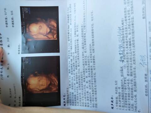 四个月胎儿图彩超图片