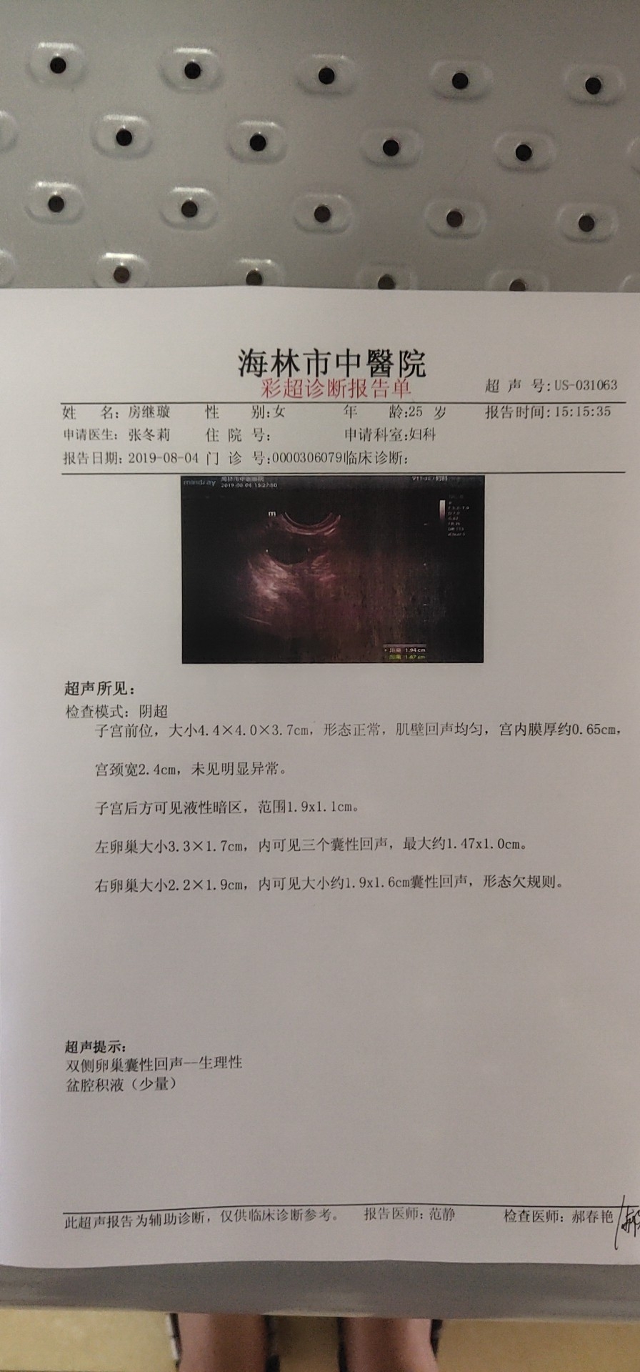 卵泡多大才能怀孕