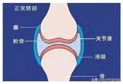 膝盖积液中医怎么治疗