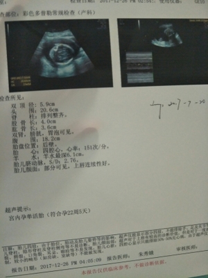 胎儿22周图片