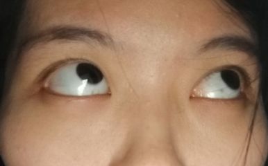 眼睛一般是多少度正常吗