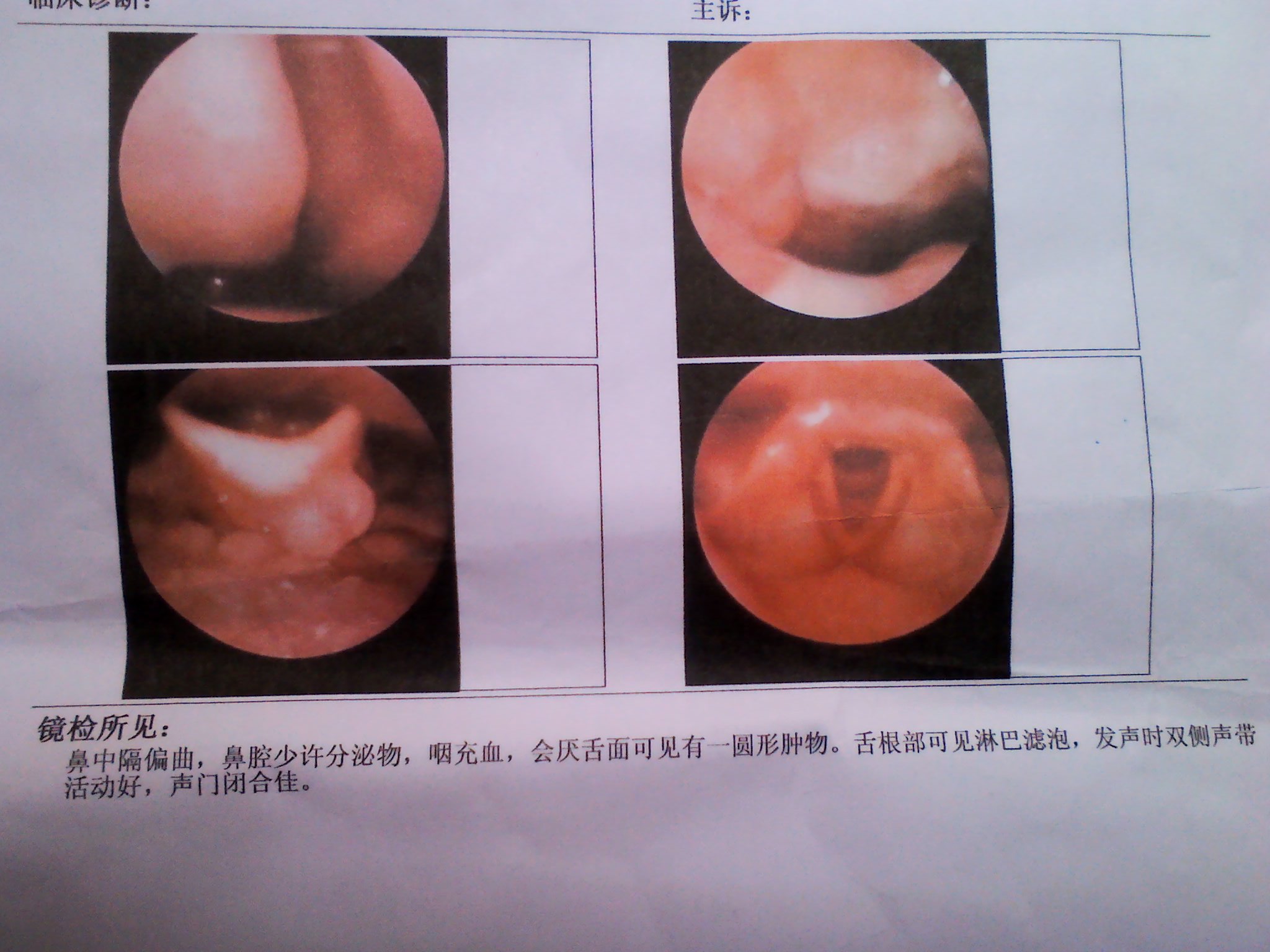 痰发绿是怎么回事