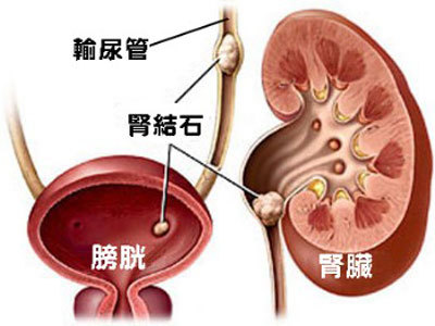 肾的两边疼是怎么回事