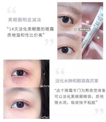 什么眼霜可以去眼袋