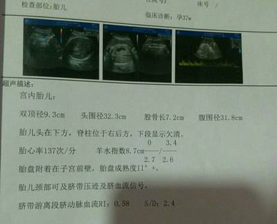 足月胎儿双顶径头围标准是多少正常值