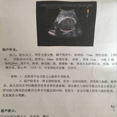 胎儿七个月双顶径标准