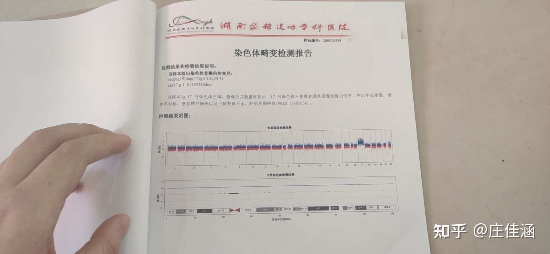 绒毛染色体基因检查多少钱