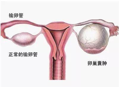排卵期出血症状及血量