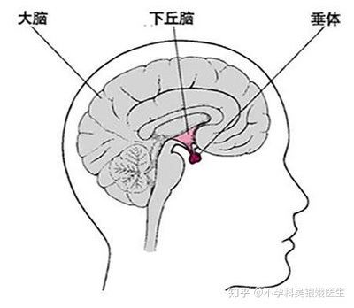 下丘脑综合征怎么治疗