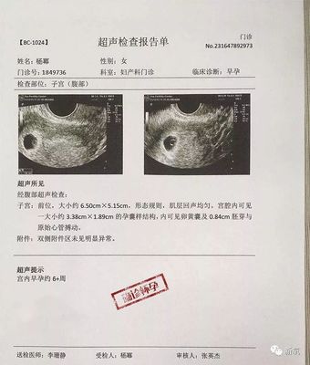 怀孕检测报告单