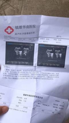 停经8天能测出怀孕吗