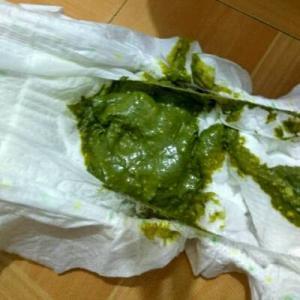 八个月宝宝拉绿屎