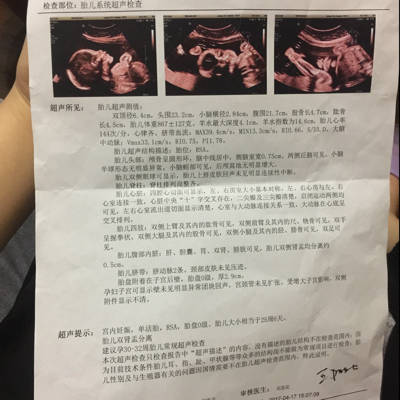 30周胎儿图片